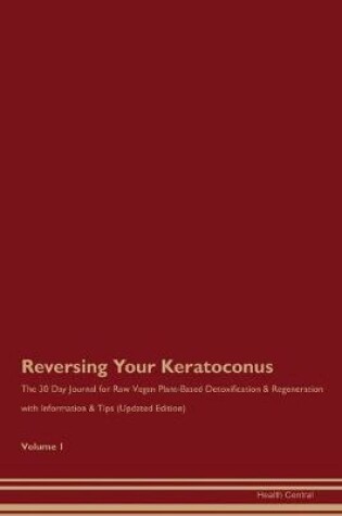 Cover of Reversing Your Keratoconus