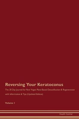 Book cover for Reversing Your Keratoconus