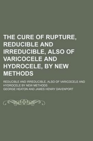 Cover of The Cure of Rupture, Reducible and Irreducible, Also of Varicocele and Hydrocele, by New Methods; Reducible and Irreducible, Also of Varicocele and Hydrocele by New Methods