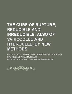 Book cover for The Cure of Rupture, Reducible and Irreducible, Also of Varicocele and Hydrocele, by New Methods; Reducible and Irreducible, Also of Varicocele and Hydrocele by New Methods