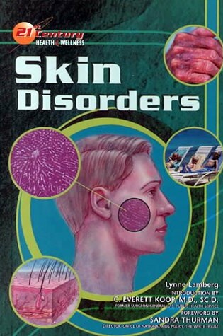 Cover of Skin Disorders (21st C Health) (Oop)