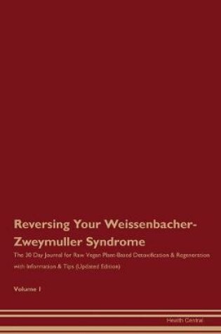 Cover of Reversing Your Weissenbacher-Zweymuller Syndrome