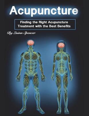 Book cover for Acupuncture