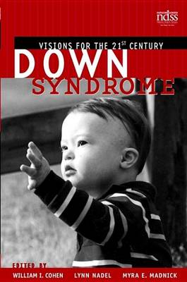 Cover of Down Syndrome