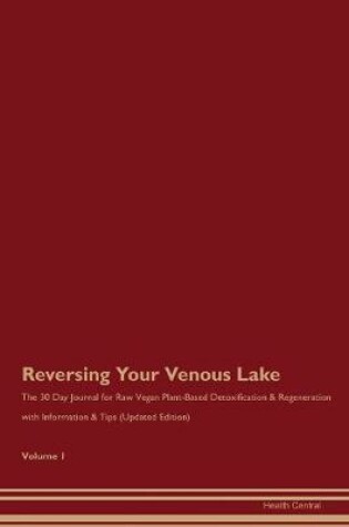 Cover of Reversing Your Venous Lake