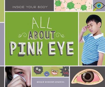 Book cover for All about Pink Eye