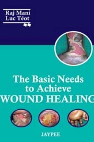 Cover of The Basic Needs to Achieve Wound Healing