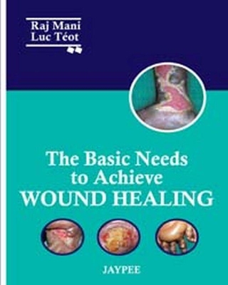 Cover of The Basic Needs to Achieve Wound Healing