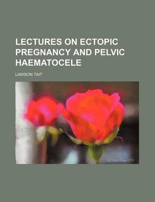 Book cover for Lectures on Ectopic Pregnancy and Pelvic Haematocele