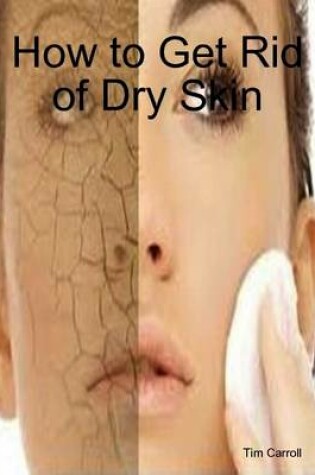 Cover of How to Get Rid of Dry Skin