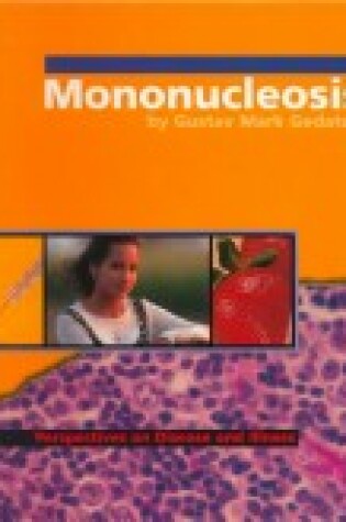 Cover of Mononucleosis