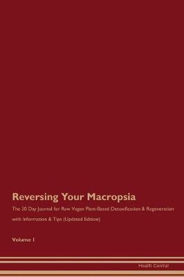 Book cover for Reversing Your Macropsia