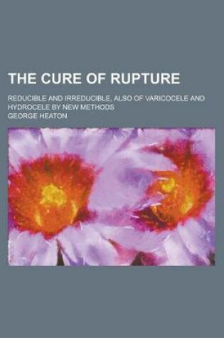 Cover of The Cure of Rupture; Reducible and Irreducible, Also of Varicocele and Hydrocele by New Methods