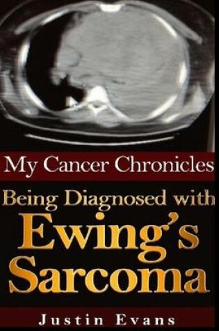 Cover of My Cancer Chronicles