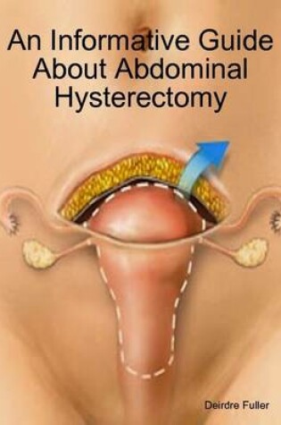 Cover of An Informative Guide About Abdominal Hysterectomy