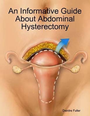 Book cover for An Informative Guide About Abdominal Hysterectomy