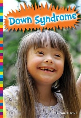 Cover of Down Syndrome