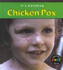 Cover of Chicken Pox