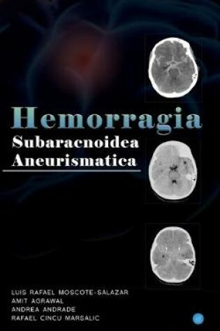 Cover of Hemorragia Subaracnoidea Aneurismatica