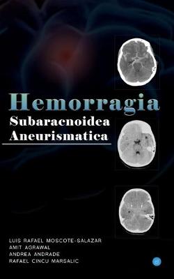 Book cover for Hemorragia Subaracnoidea Aneurismatica