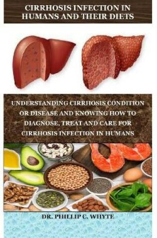 Cover of Cirrhosis Infection in Humans and Their Diets