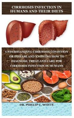 Book cover for Cirrhosis Infection in Humans and Their Diets