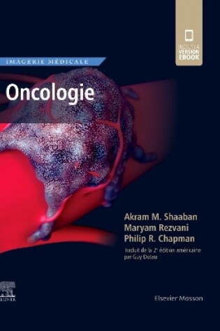 Cover of Imagerie Médicale: Oncologie