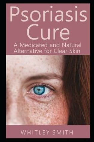 Cover of Psoriasis Cure