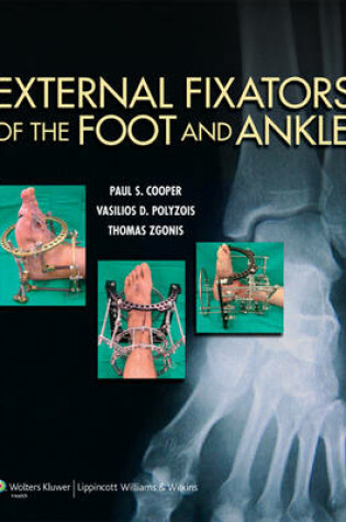 Cover of External Fixators of the Foot and Ankle