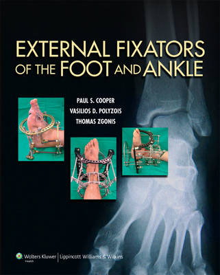 Cover of External Fixators of the Foot and Ankle