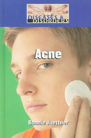 Cover of Acne