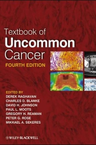 Cover of Textbook of Uncommon Cancer