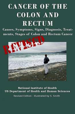 Book cover for Cancer of the Colon and Rectum