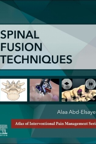 Cover of Spinal Fusion Techniques - E-Book