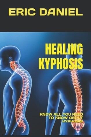 Cover of Healing Kyphosis