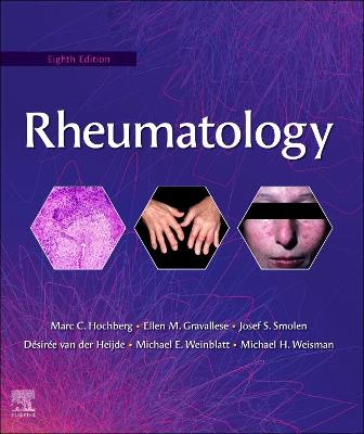 Cover of Rheumatology E-Book