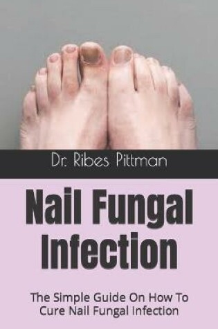 Cover of Nail Fungal Infection