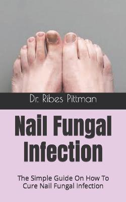 Book cover for Nail Fungal Infection