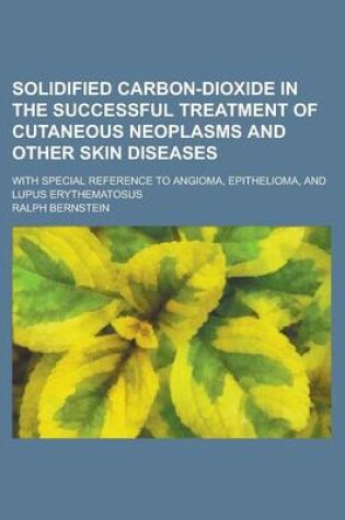 Cover of Solidified Carbon-Dioxide in the Successful Treatment of Cutaneous Neoplasms and Other Skin Diseases; With Special Reference to Angioma, Epithelioma,