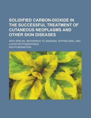 Book cover for Solidified Carbon-Dioxide in the Successful Treatment of Cutaneous Neoplasms and Other Skin Diseases; With Special Reference to Angioma, Epithelioma,