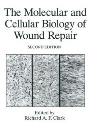 Cover of The Molecular and Cellular Biology of Wound Repair