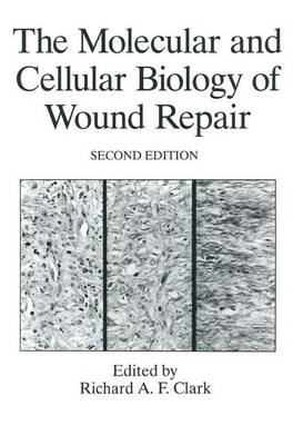 Book cover for The Molecular and Cellular Biology of Wound Repair