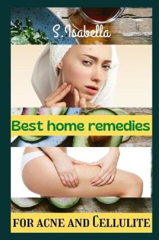 Cover of Best home remedies (for acne and Cellulite)