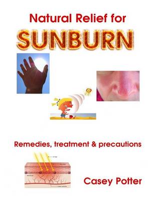 Cover of Natural Relief for Sunburn