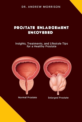 Book cover for Prostrate Enlargement Uncovered