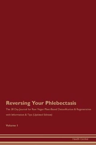 Cover of Reversing Your Phlebectasis