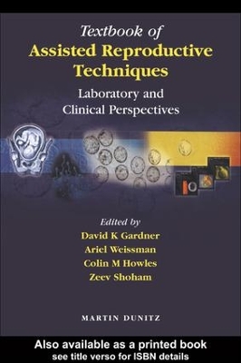 Book cover for Textbook of Assisted Reproductive Techniques