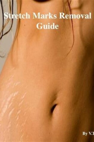 Cover of Stretch Marks Removal Guide