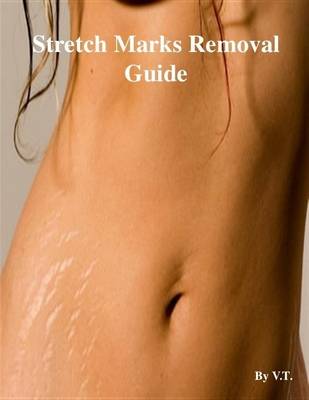 Book cover for Stretch Marks Removal Guide
