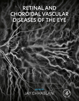 Book cover for Retinal and Choroidal Vascular Diseases of the Eye